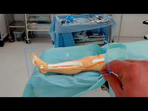 Using HoloLens at Imperial College London