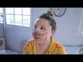 I Spent 30 Days at Richardsons Face Hospitals and Here's What Happened