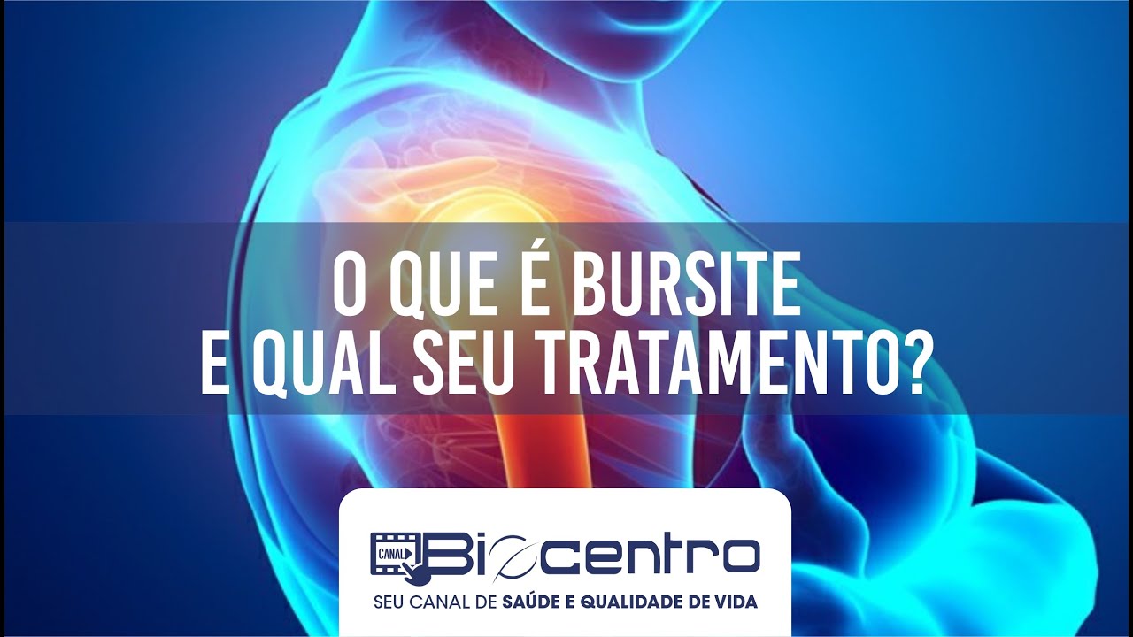 O que é bursite e qual seu tratamento?