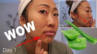 I USED FRESH ALOE VERA FOR 7 DAYS AND LOOK WHAT HAPPENED!