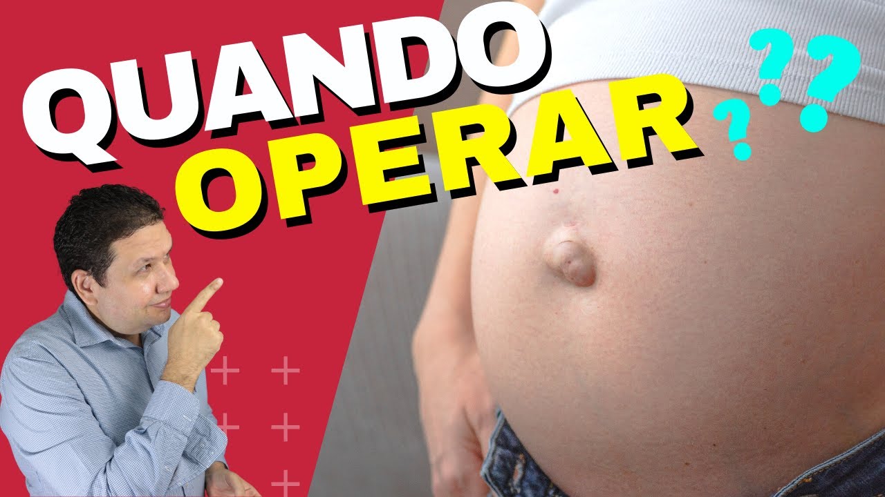 [ATENÇÃO] HÉRNIA UMBILICAL PRECISA OPERAR SEMPRE Não. Saiba quando operar de hérnia umbilical.