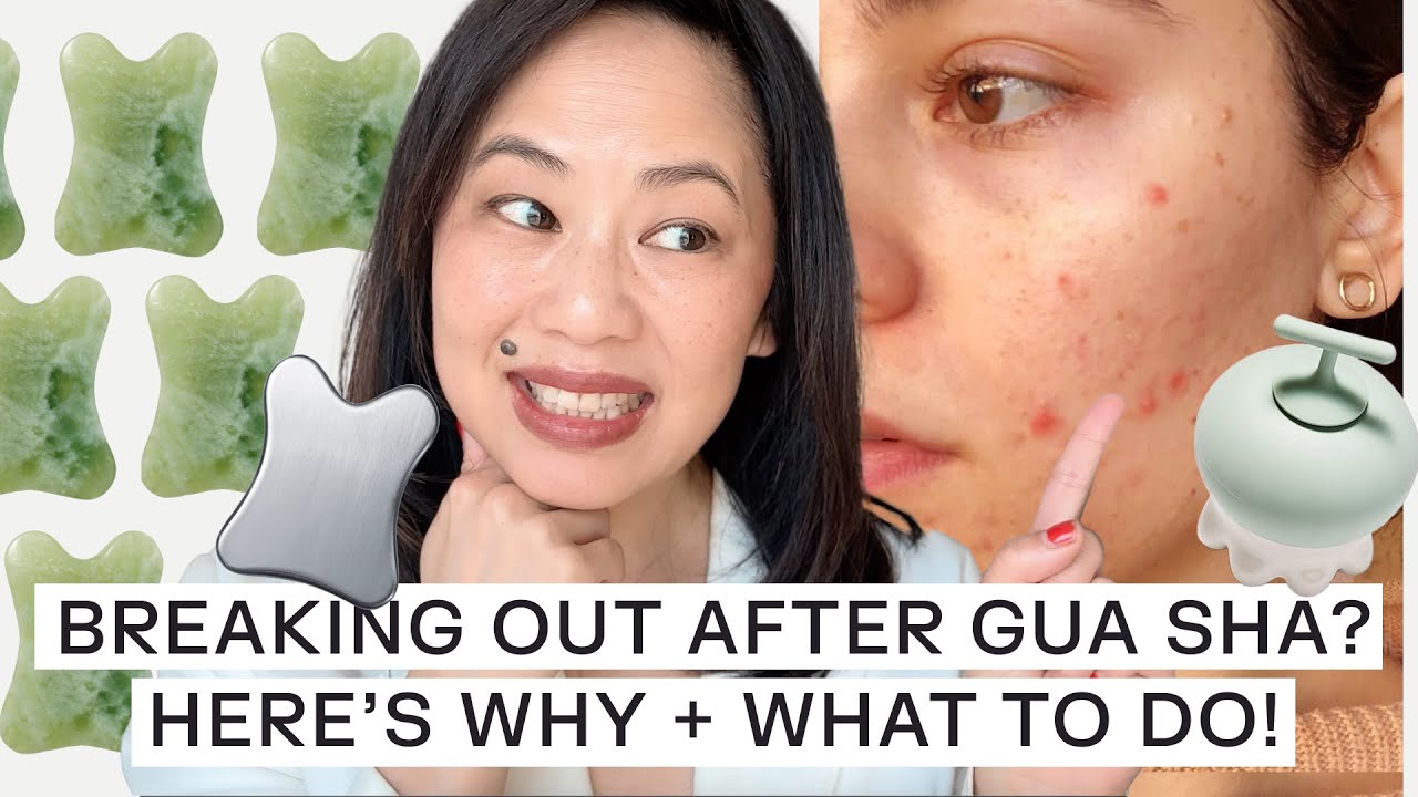 TCM Practitioner Explains Gua Sha Breakouts And How To Prevent Them