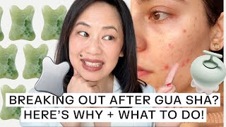 TCM Practitioner Explains Gua Sha Breakouts And How To Prevent Them