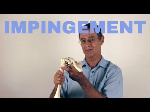 Shoulder Impingement and Common Chronic Shoulder Pain Explained