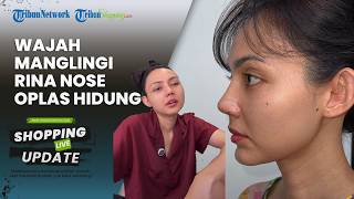 Tampil Manglingi, Potret Terbaru Rina Nose seusai Operasi Plastik Hidung Jadi Sorotan