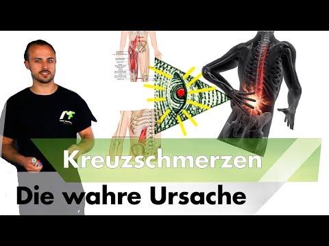 Perineuralen Zyste thorakalen Schwellung der Hände mit zervikaler Osteochondrose