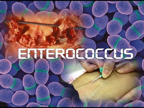 enterococcus férgek