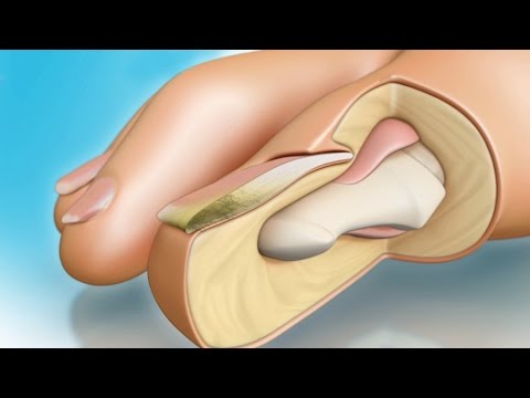Il conduttore con psoriasi Leczema su mani che trattare bambini