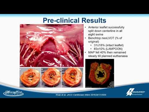 Novel Mitral Leaflet Repair for TMVR - Adam Greenbaum, MD