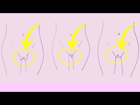 Is my v*agina normal Here are the 7 different types of labia | Natural Life Video