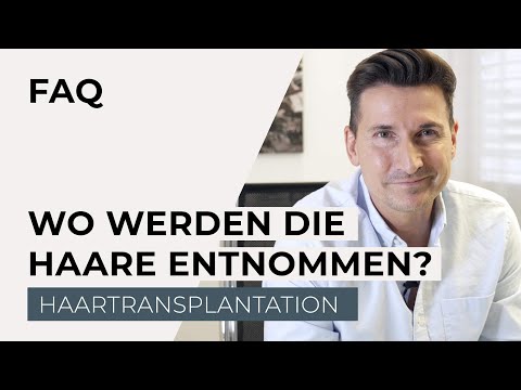 Haartransplantation - Wo können die Haare für eine Transplantation entnommen werden?