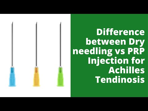 Difference between Dry needling vs PRP Injection for Achilles Tendinosis
