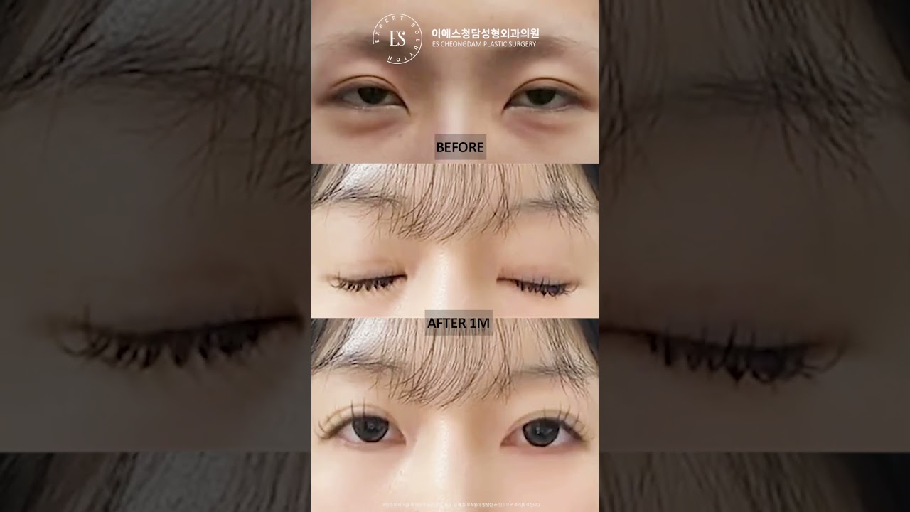 이에스 유튜브