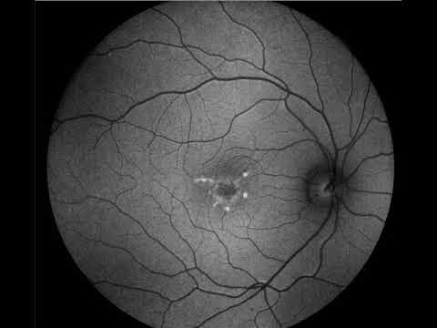 [ Acid HardCore ] NeedGhost - Degeneration