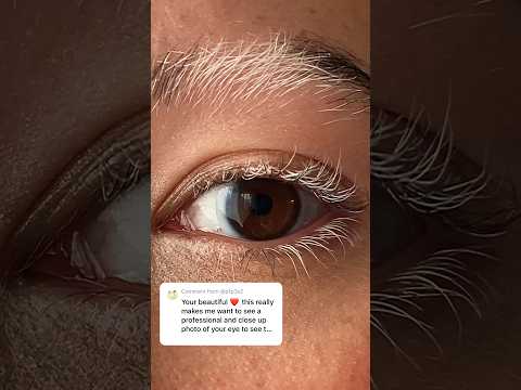 Wait for it 🤍🖤….. #vitiligo #poliosis #eyebrows #eyelashes #myjourney