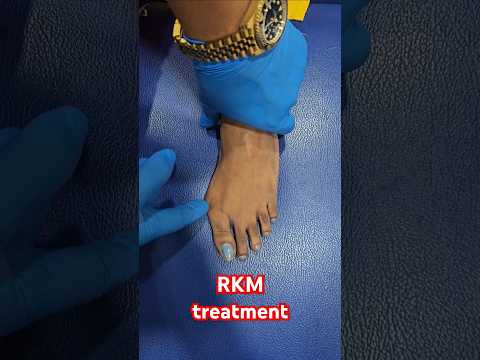 #RKM  #worldfamouschiropractor  #drrajneeshkant  #chiropractic