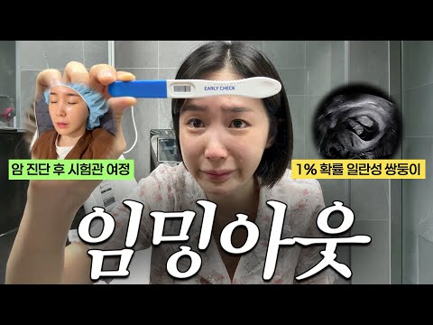 암 진단 후 시험관 임신성공, 1%확률의 일란성 쌍둥이..?!