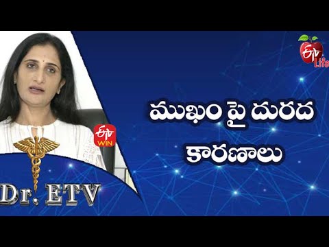 Causes of Dermatitis | ముఖం పై దురద - కారణాలు | Dr.ETV | 6th December 2021| ETV Life