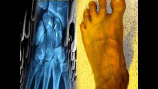 The Residents - Blood on the Bunny