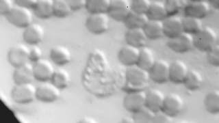 Self made microscope 10 - Live blood, Neutrophil