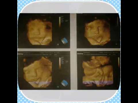 Te amoo hijo mio ( Dylan Nahuel )