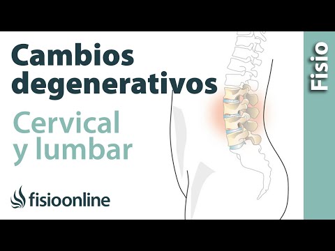 Naturaleza del dolor de espalda en las metástasis Parte superior del brazo a las letras articulación del codo de 5