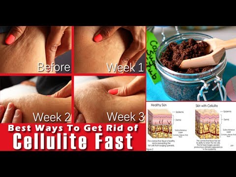 Reduxine gastos sa mga parmasya Volgograd Stimol at slimming