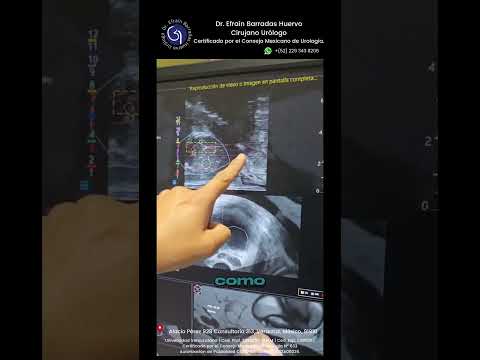 Efrain Barradas Huervo-47
