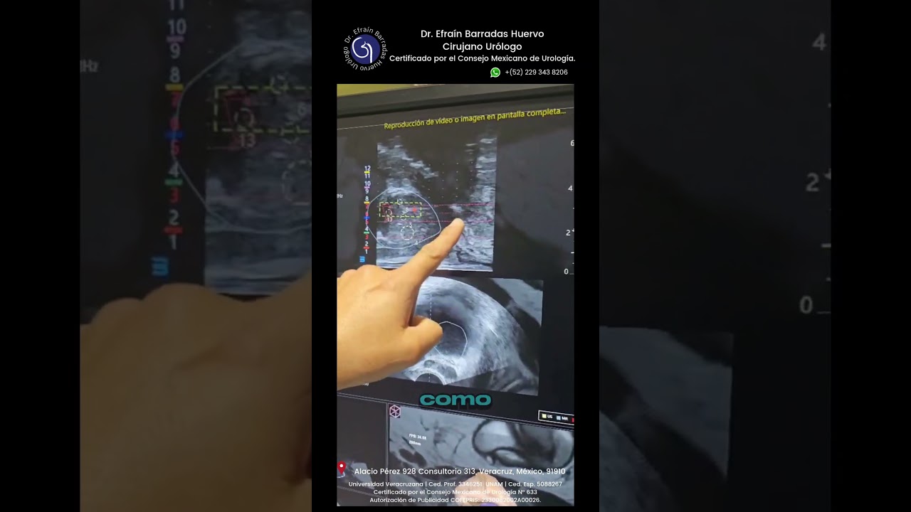 Efrain Barradas Huervo-47