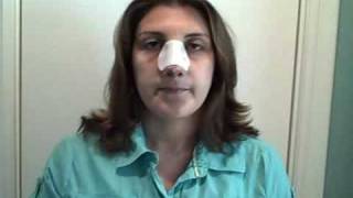 My New Nose…Again! VJournal: Post-Op Day 2
