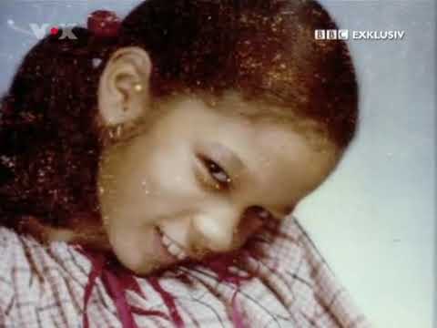 BBC Exklusiv - Lebendig versteinert (Münchmeyer-Syndrom FOP)