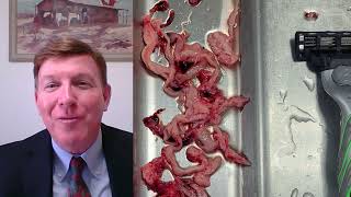 Dr John Campbell More on the White Fibrous Clots being Found in the Deceaseds Arteries