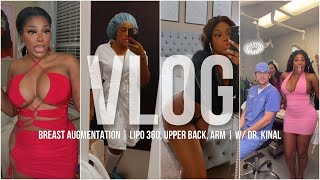 Plastic Surgery Vlog: Breast Augmentation | 360, Upper Back, Arm Lipo | Dr. Kinal