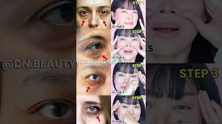 Fix Sunken Eyes 👁✨ Remove Hollows &amp; Dark Circles #FixSunkenEyes #DarkCircles #EyeHack #FaceYoga