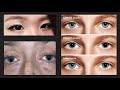 EyeKinetix Overview