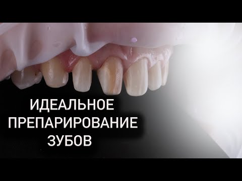 Секрет идеального препарирования зубов