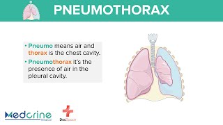Pneumothorax: Definition, Types and classification Preview