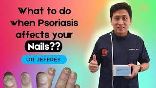 Final EP | Nail Psoriasis | What should you do? | Gorgeous Clinic | Dr. Jeffery | Dr. Chiam | 2021