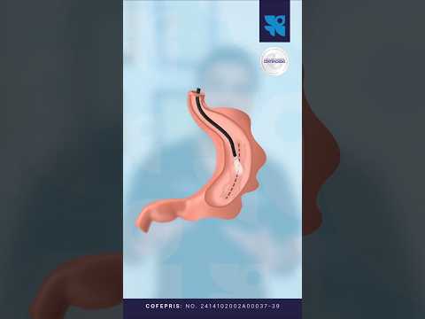 Ernesto Plasencia Camacho-9