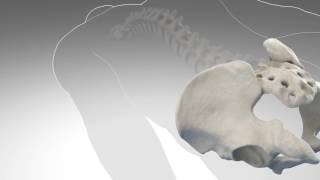 iFuse Video   Sacroiliac Joint Fusion