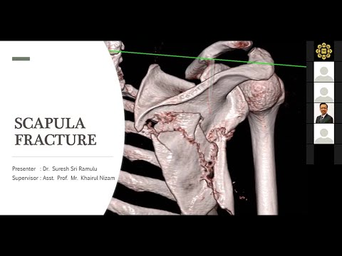 Lecture Series 7 : Scapula Fracture