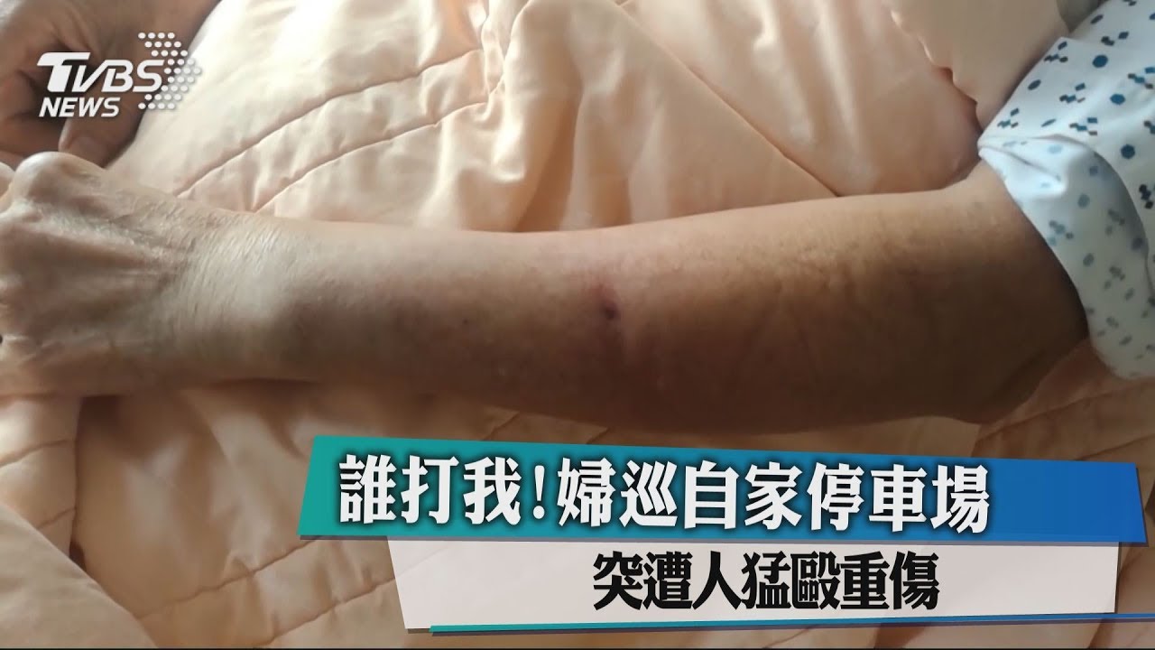 誰打我！婦巡自家停車場　突遭人猛毆重傷