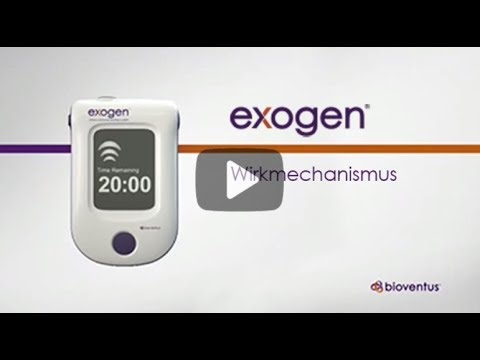 EXOGEN-Wirkmechanismus (de)