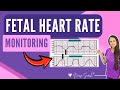 Fetal Heart Tone Monitoring: Accelerations & Decelerations Explained