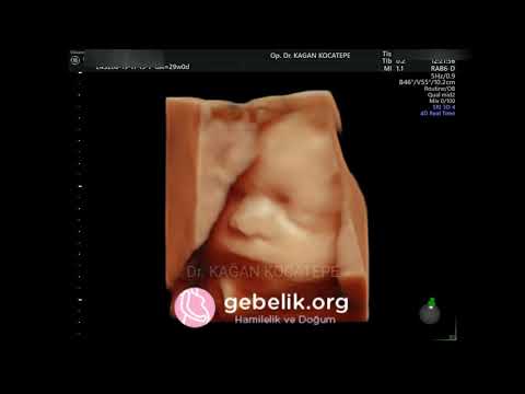 How does a 29 weeks old baby's face look like on a 4 dimensional ultrasound? Mimics in the womb!