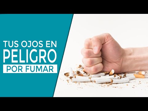 Lo que le puede pasar a tus ojos por fumar - Día mundial sin tabaco