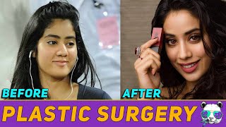 Bollywood Celebrity who have Allegedly Undergone Plastic Surgery | Mridul Madhok