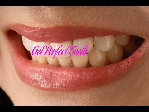 Get Perfect Teeth ║  Affirmations ║  Results