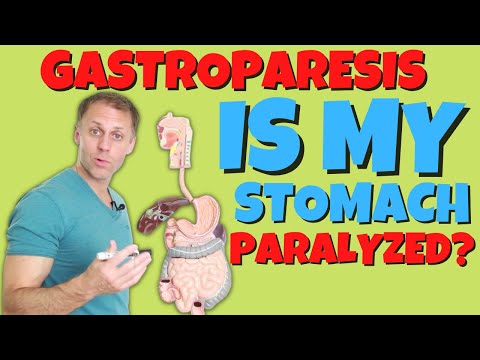 Gastroparesis and Constipation Explained in Simple Terms
