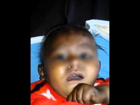 Treatment for infant experiencing tremors for a week